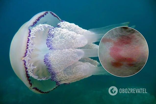 Курорт на Азовском море атаковали медузы: у отдыхающих ожоги. Фото и видео
