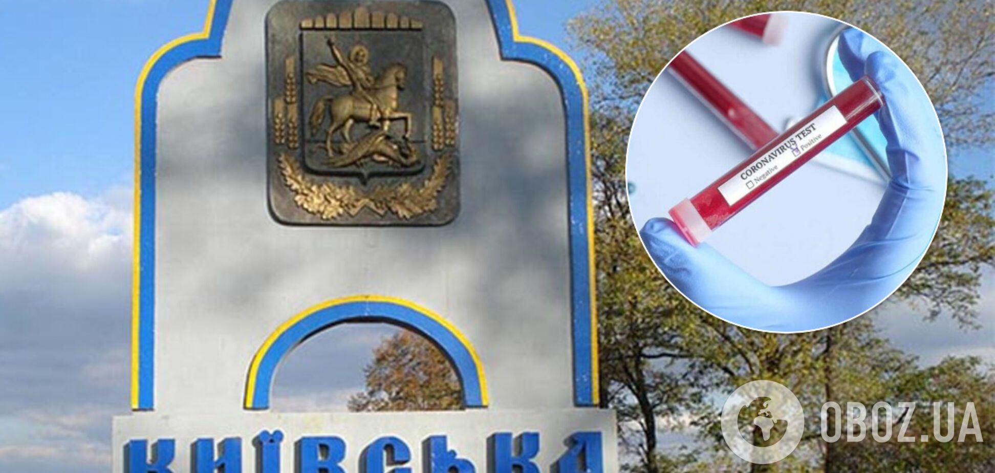 На Киевщине выросло количество зараженных коронавирусом: в Минздраве опубликовали свежие данные