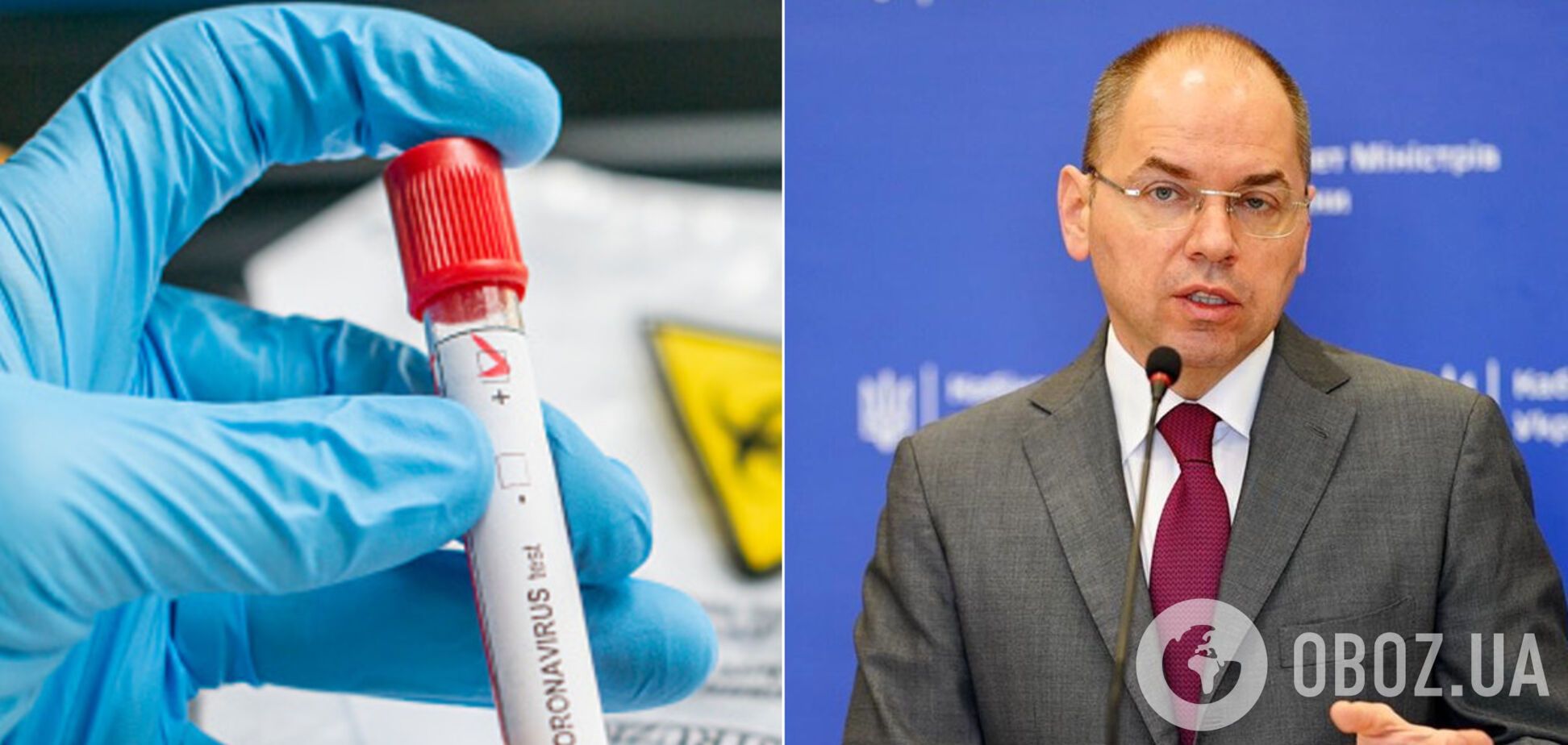 Степанов озвучив статистику щодо коронавірусу в Україні