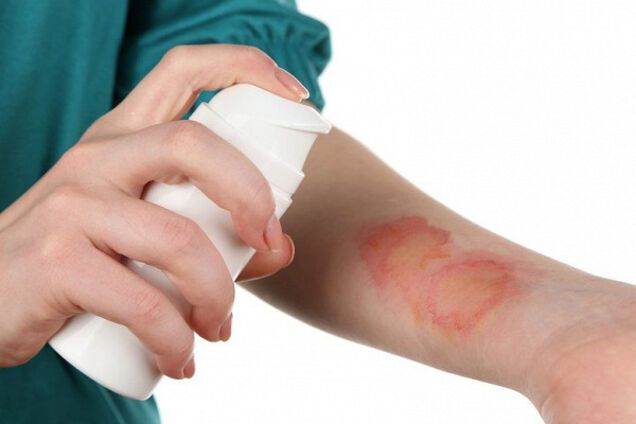 Проблемы с кожей летом: врач из Днепра рассказала о первой помощи и опасностях