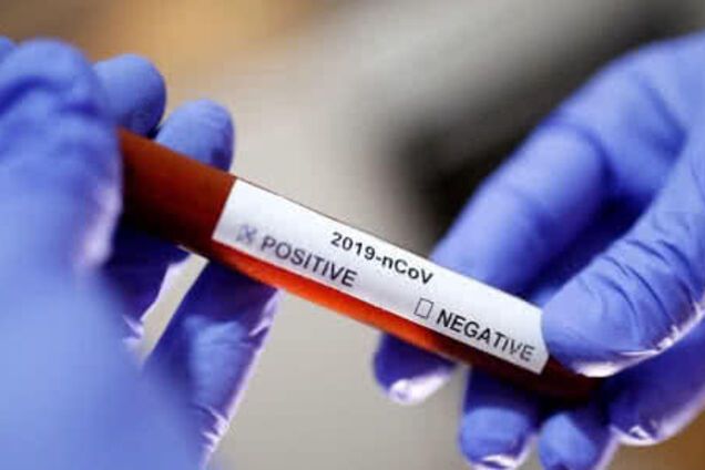 У Дніпрі зафіксували новий смертельний випадок коронавірусу: свіжа статистика