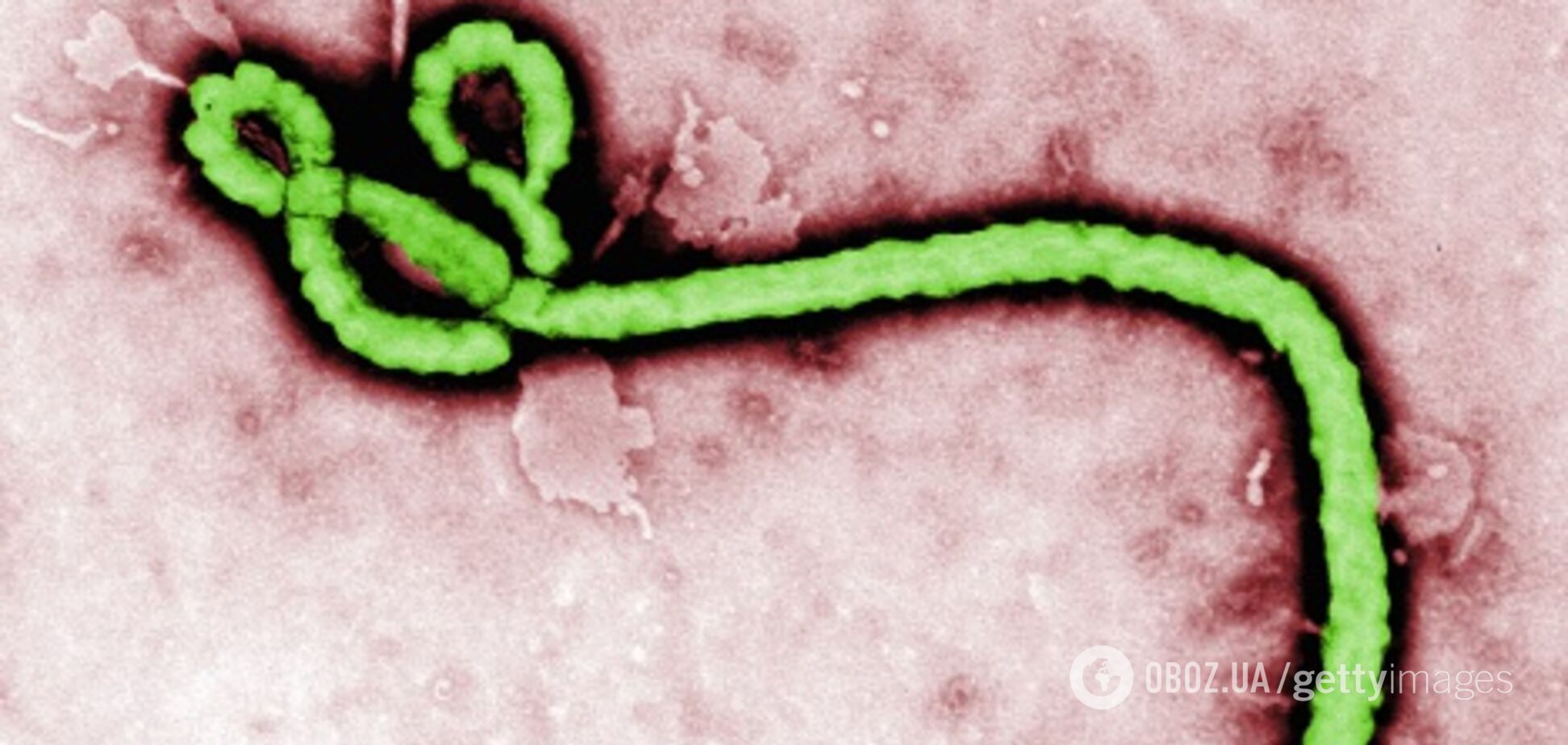 Эбола вспыхнула с новой силой: назван эпицентр, количество больных растет