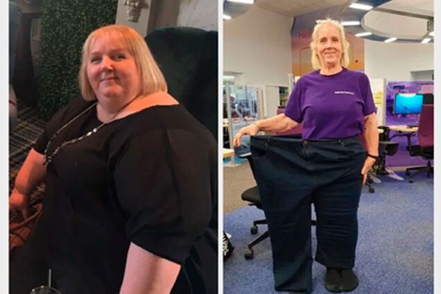 Скинула 102 кг: жінка поділилася секретом успішного схуднення і здивувала фото