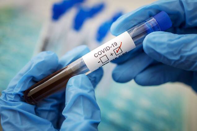 У Дніпрі збільшилася кількість заражених коронавірусом