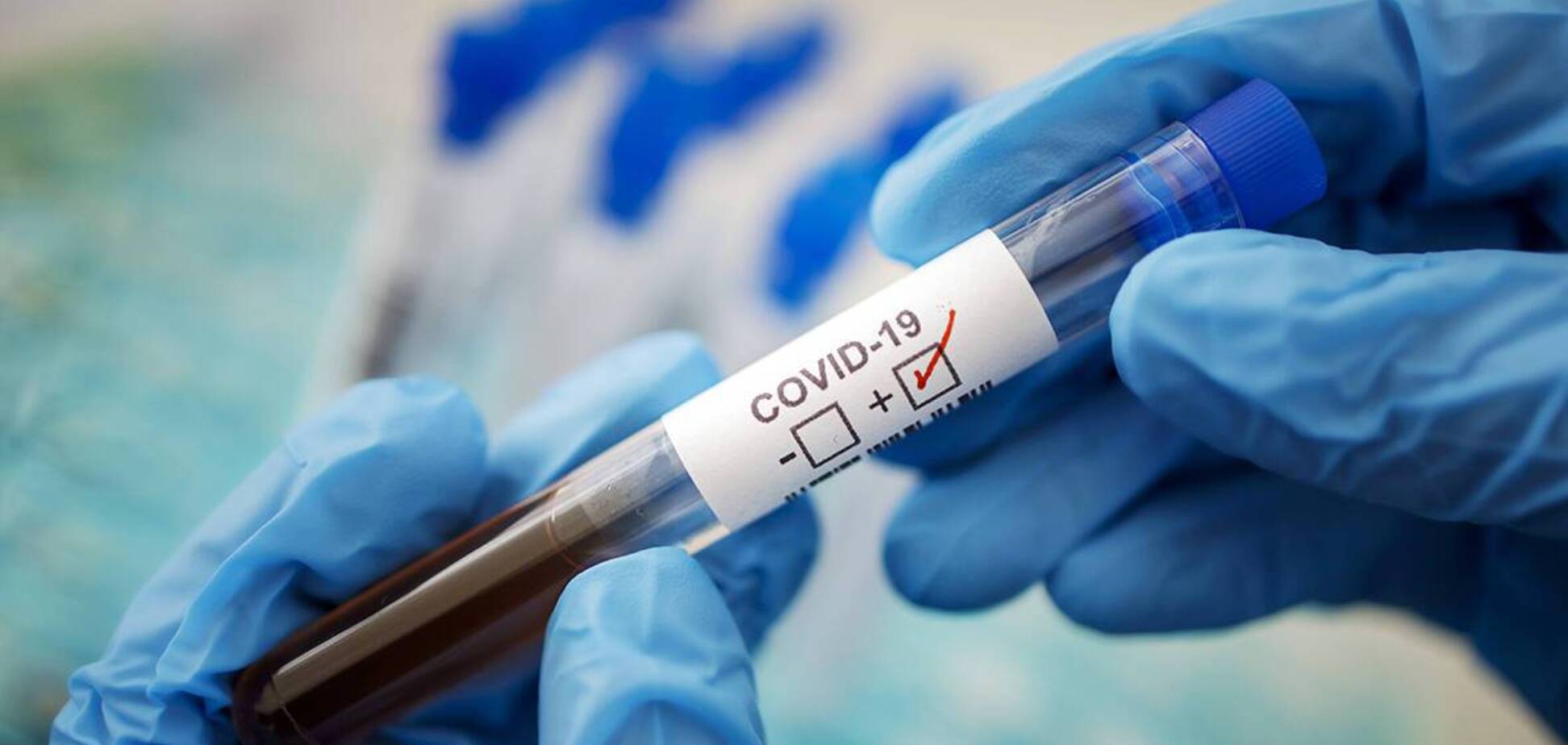 У Дніпрі збільшилася кількість заражених коронавірусом