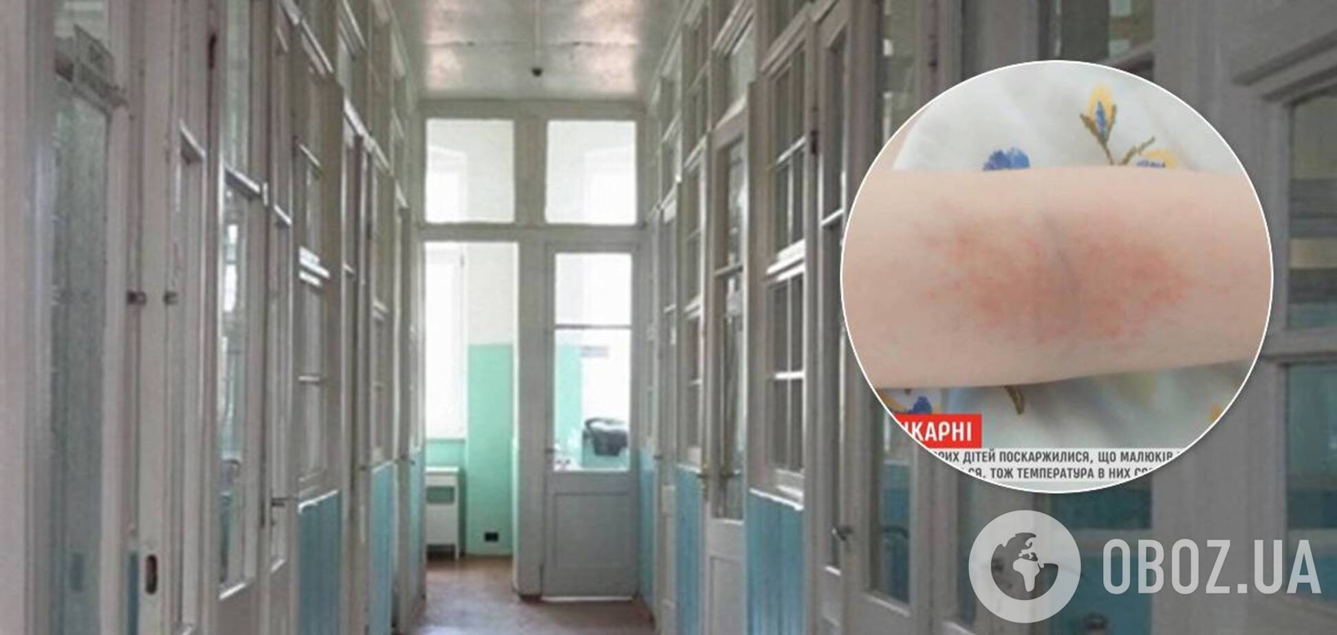 В больнице Винницы онкобольных детей закрыли в палатах в страшную жару из-за карантина
