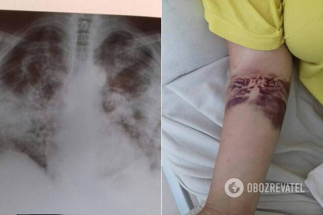 Врач показала фото из COVID-центра на Закарпатье: скорые ежедневно привозят новых больных