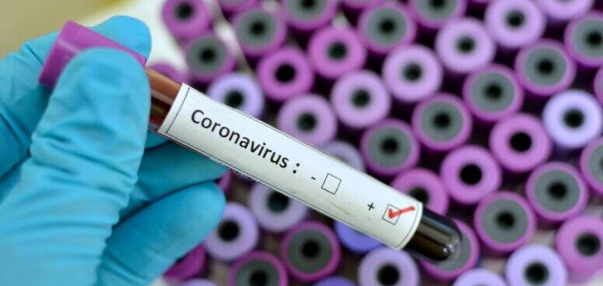 У Дніпрі виявили нові випадки зараження COVID-19: актуальна статистика
