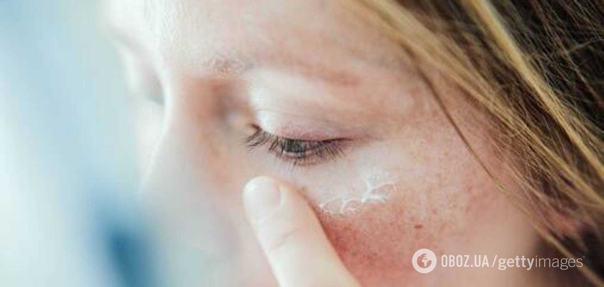 Женщина лишилась зрения из-за лечебного крема