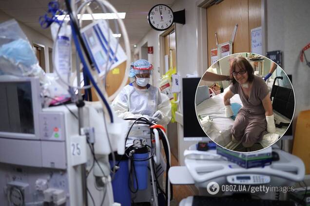 Переболевшая коронавирусом женщина лишилась рук и ног: осложнение пришло через пару недель