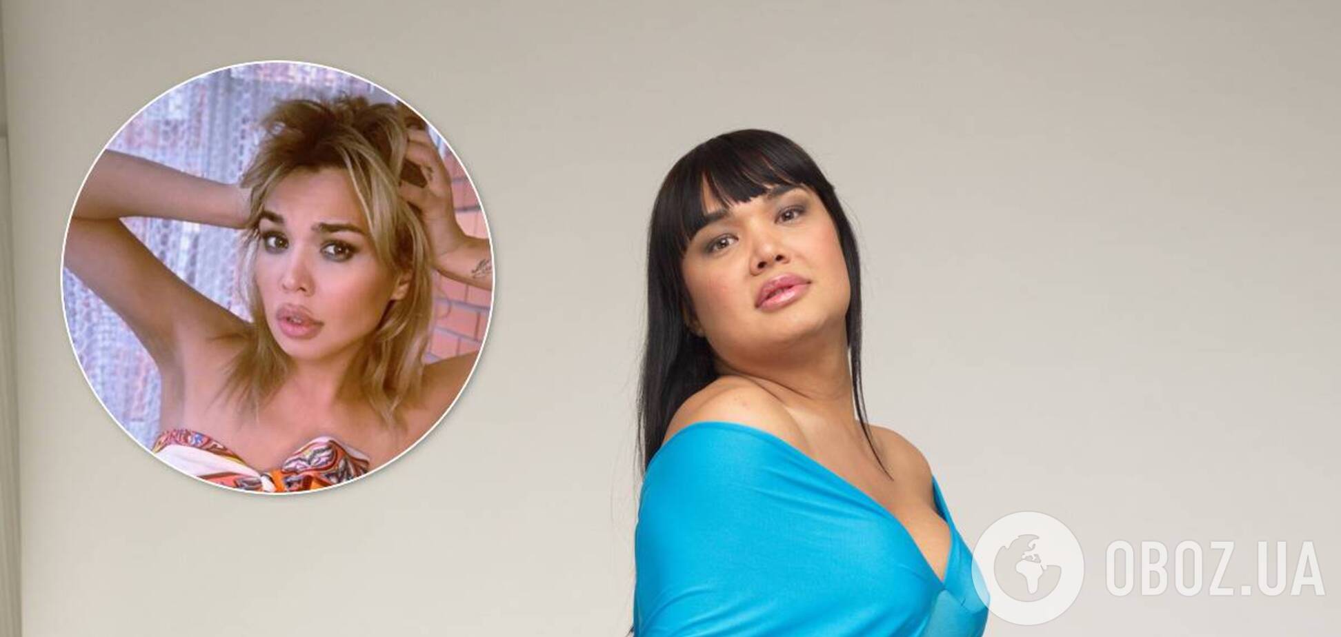 Звезда украинского реалити кардинально изменилась после пластики: как выглядит сейчас