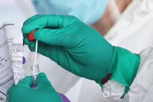 Чоловік у США захворів на COVID-19 через три місяці після повного одужання