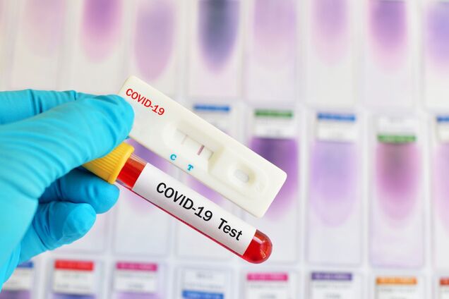 Названа еще одна опасность коронавируса: под угрозой новые органы