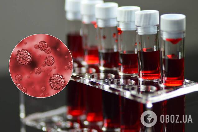 Названо групи крові, найбільш схильні до COVID-19