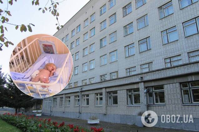 В Кременчуге родилась девочка 'без кожи'