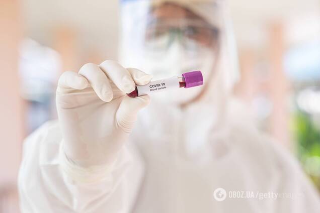 Українці заразилися коронавірусом на фермі у Німеччині