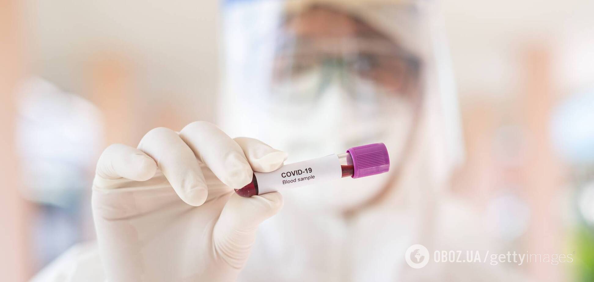 Украинцы заразились коронавирусом на ферме в Германии