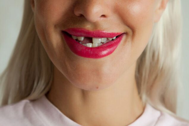 До чого сниться, що випадають зуби