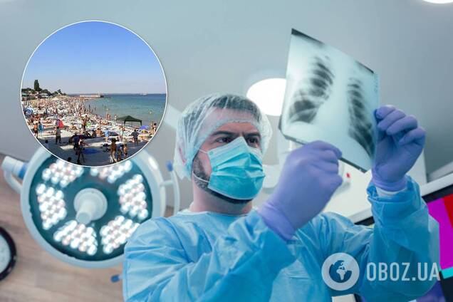 В Одесі від ускладнень COVID-19 померла туристка