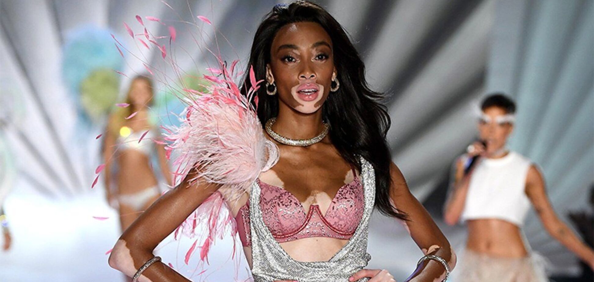 Відома модель із хворобою шкіри вразила мережу пікантними фото в купальнику