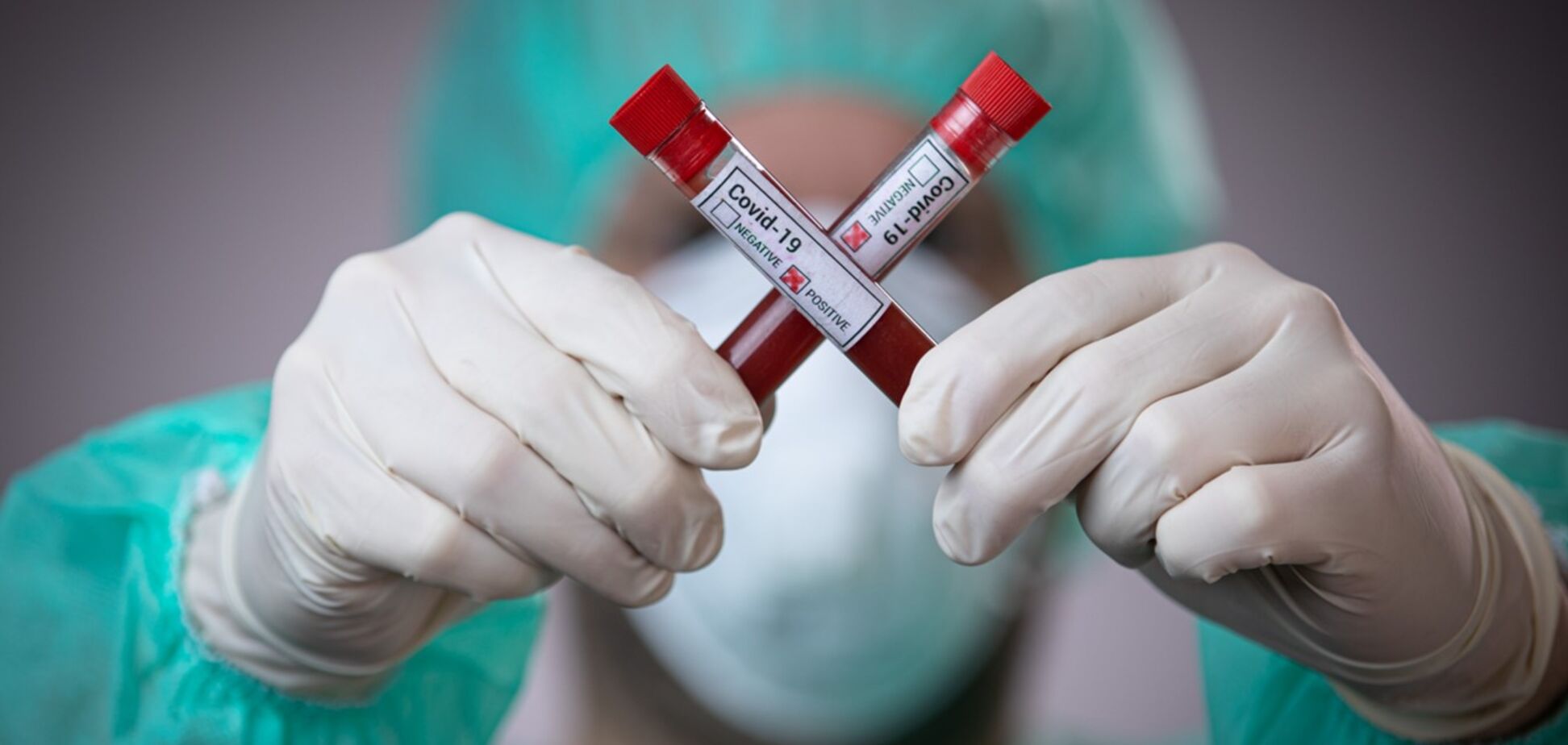 В Днепре увеличилось количество зараженных коронавирусом