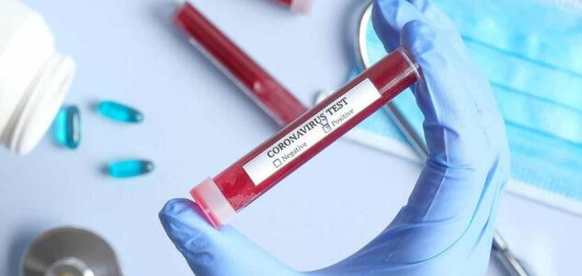 В Днепре увеличилось количество зараженных коронавирусом