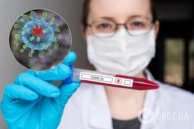 Епідемія COVID-19 в Україні йде на спад. Позитивний сценарій НАН