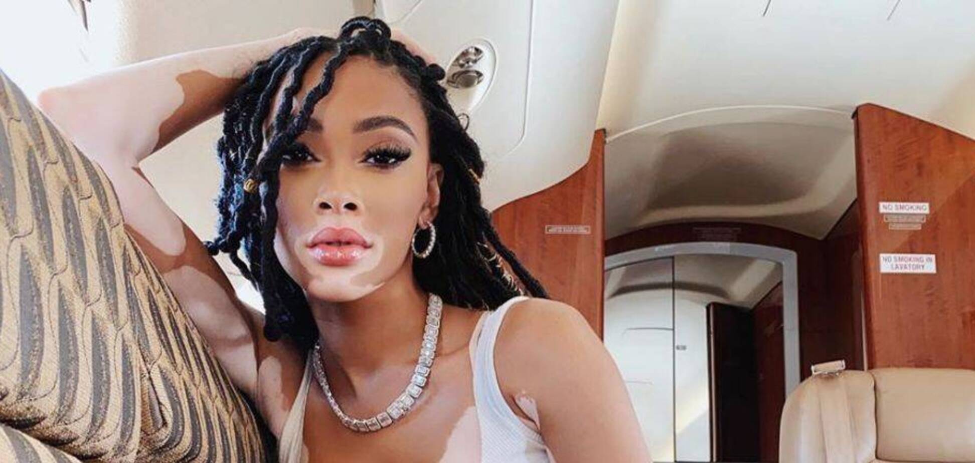 Известная модель с болезнью кожи засветила роскошный частный самолет. Фото и видео