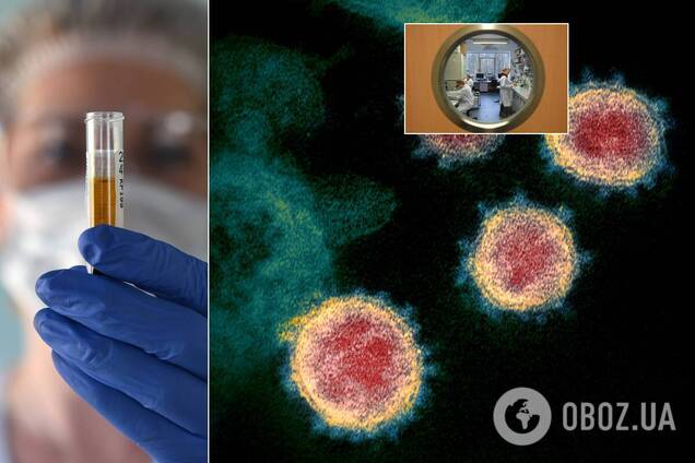 Коронавирус несет фрагмент ВИЧ и быстро мутирует, медики за ним не успевают, – эпидемиолог