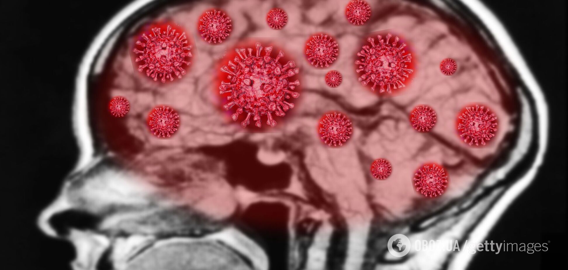 Коронавирус может быть очень опасным для работы мозга человека