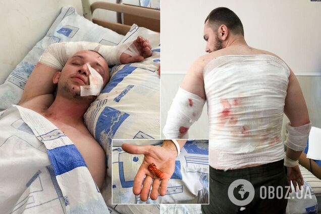 Пострадавшие во время протестов в Беларуси