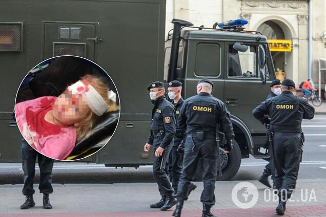 У Білорусі під час розгону ОМОНом постраждала 5-річна дитина. Фото