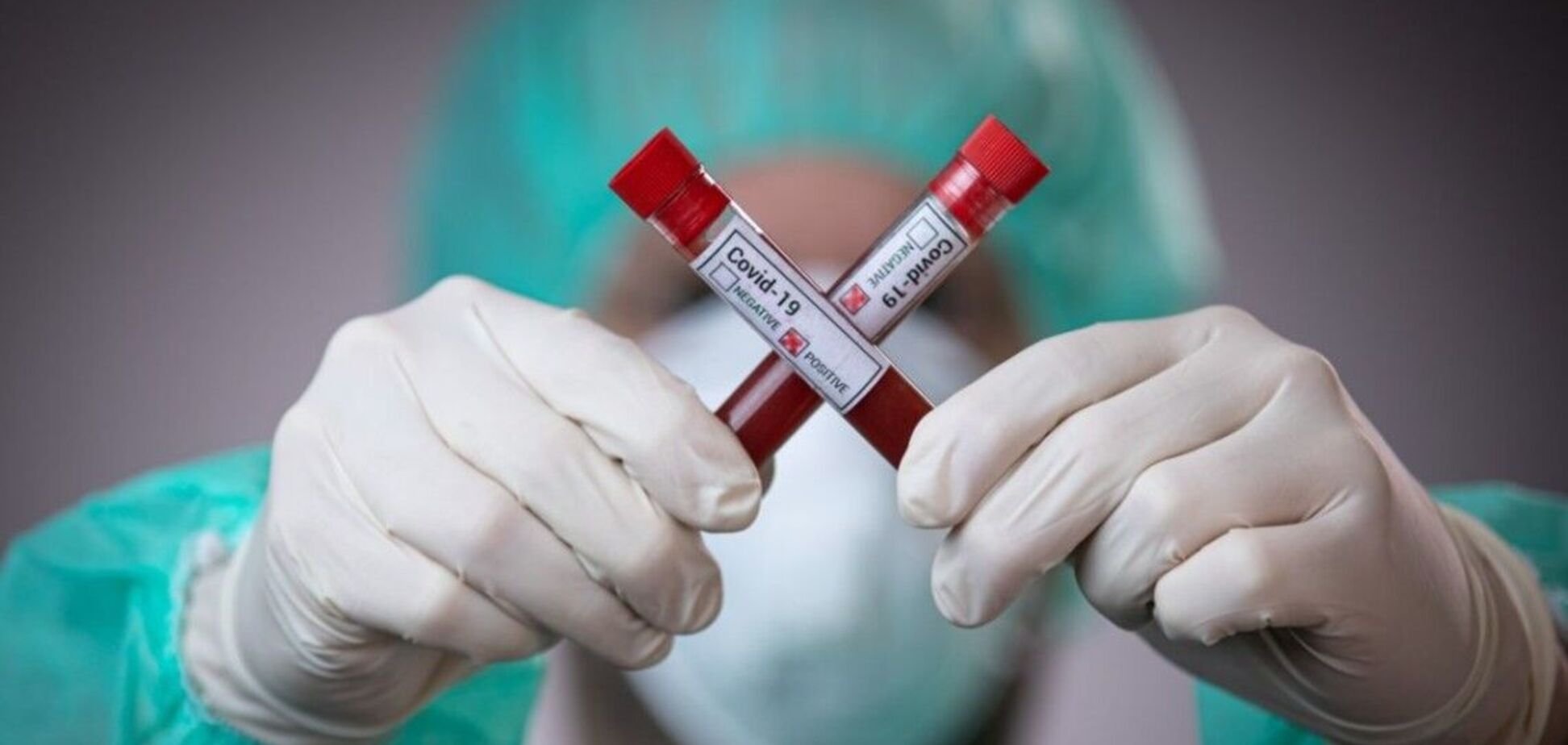 В крови человека нашли пять признаков смертельной формы коронавируса