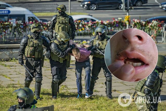 У Білорусі силовики розповіли, як їм дісталося від мітингувальників