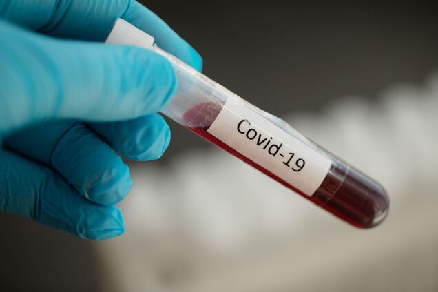 На Киевщине коронавирус обнаружили у еще почти 70 человек