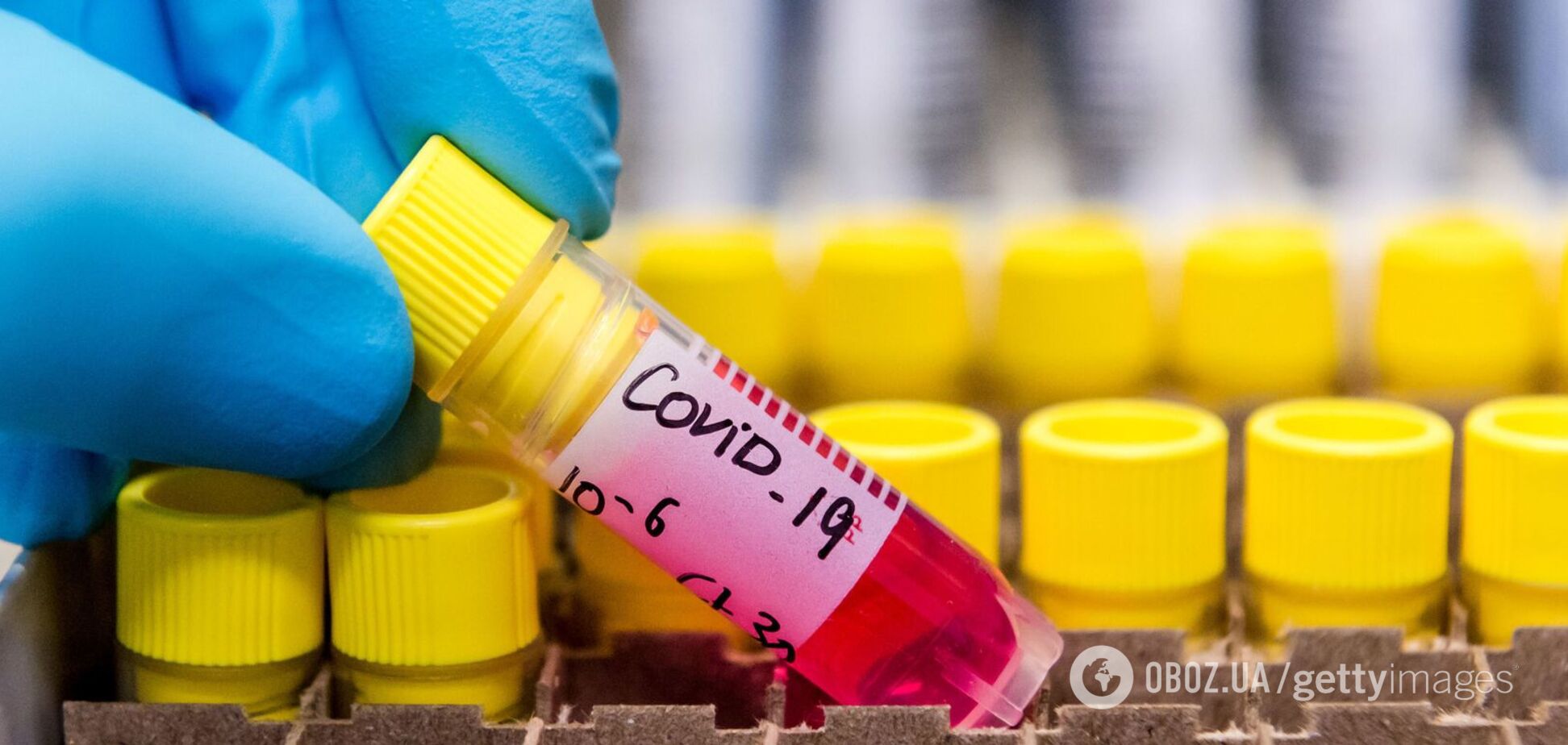 В больнице Херсона вспышка коронавируса