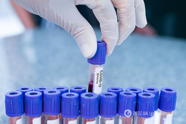 В Британии на фабрике сладостей обнаружили более 70 больных COVID-19