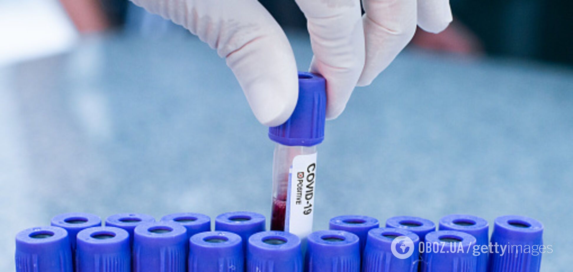 В Британии на фабрике сладостей обнаружили более 70 больных COVID-19