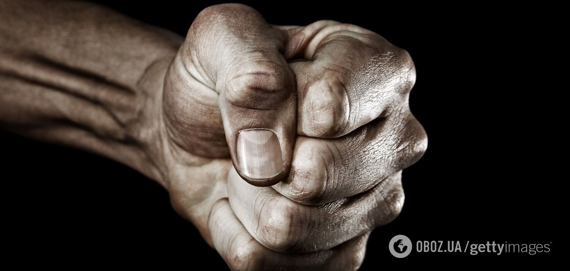 На Черниговщине мужчина умер в 'скорой' после жестокого избиения