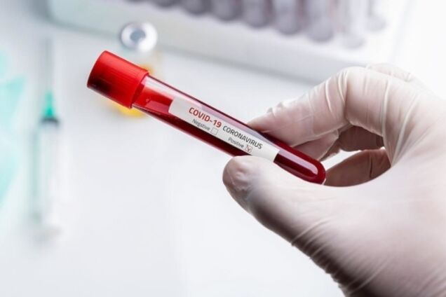 У Дніпрі за добу не виявили нових випадків COVID-19