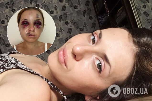 Анастасію Лугову побили і спробували зґвалтувати в поїзді