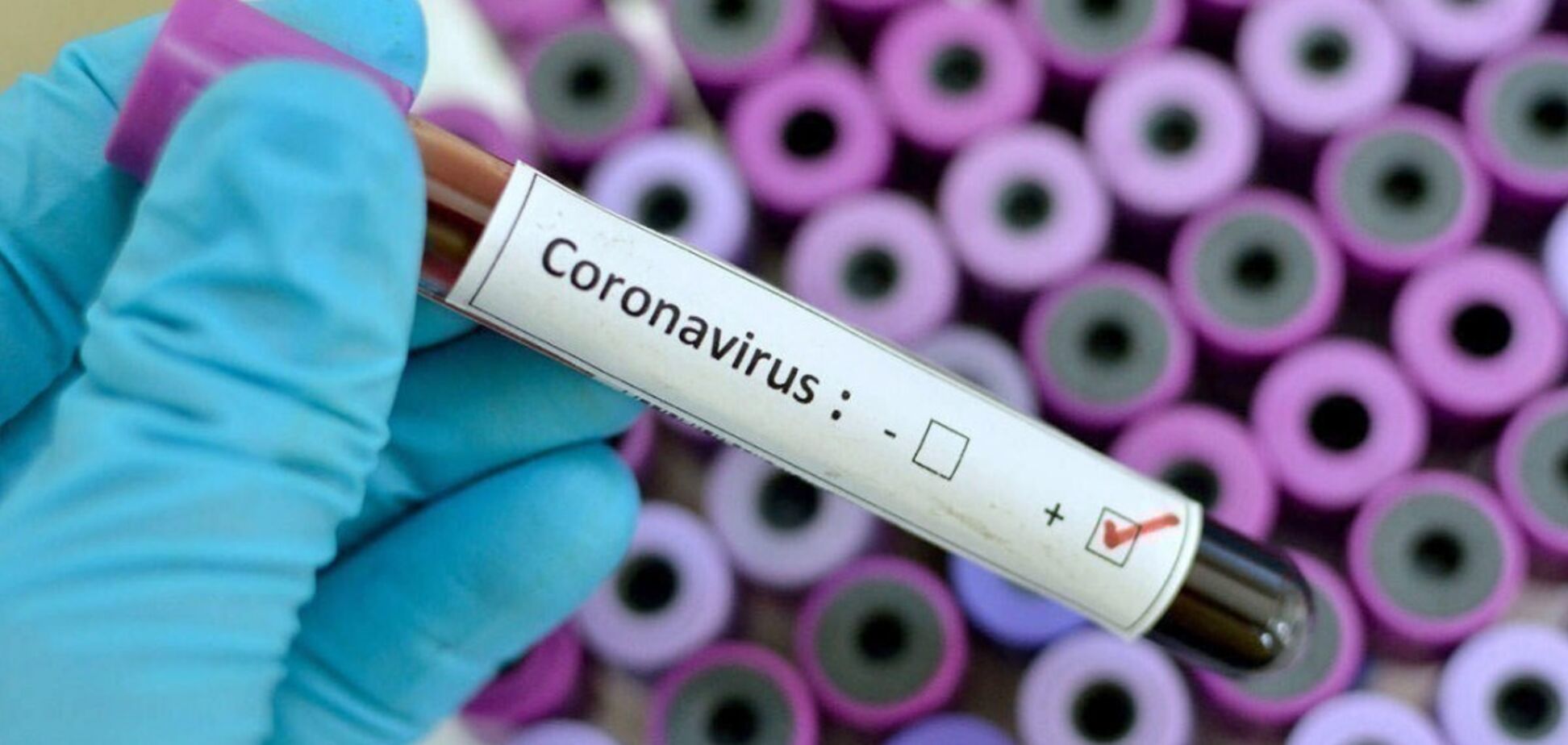 Коронавірус в Дніпрі: опублікована свіжа статистика захворюваності
