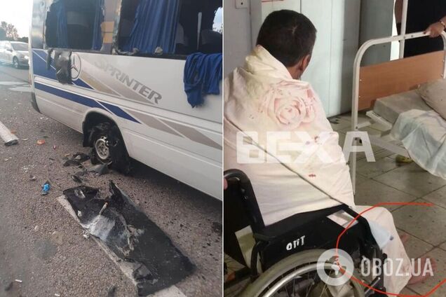 В сети показали кадры из больницы с пострадашими под Харьковом