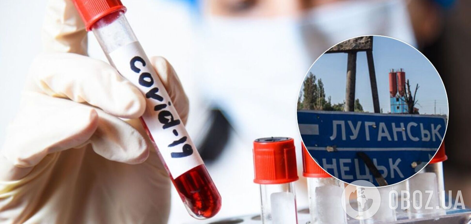 Дані про COVID-19 у Криму та ОРДЛО надає розвідка, – Степанов