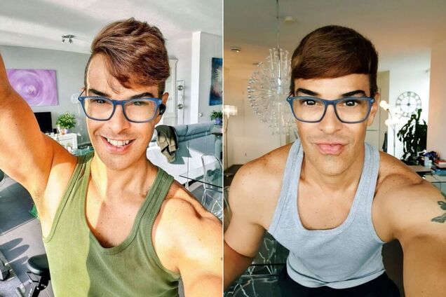 Едсон Брандао ніколи не вдавався до послуг пластичних хірургів