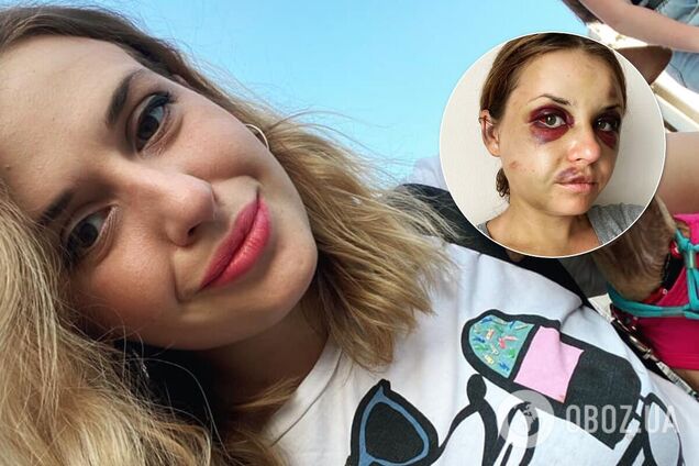 Анастасія Лугова вважає, що нападник діяв за налагодженою схемою