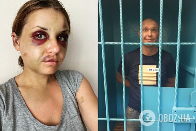 Анастасія Лугова піддалася нападу Віталія Рудзька