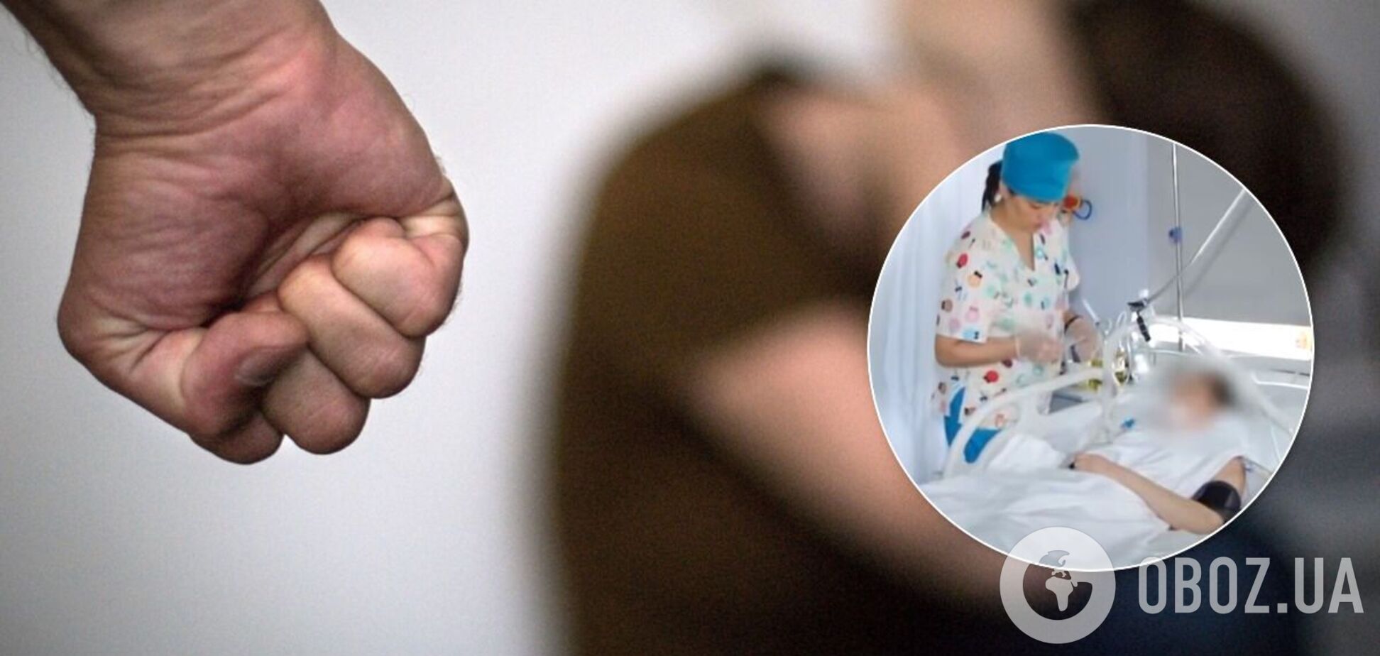 На Дніпропетровщині чоловік побив дружину до коми: постраждала в реанімації