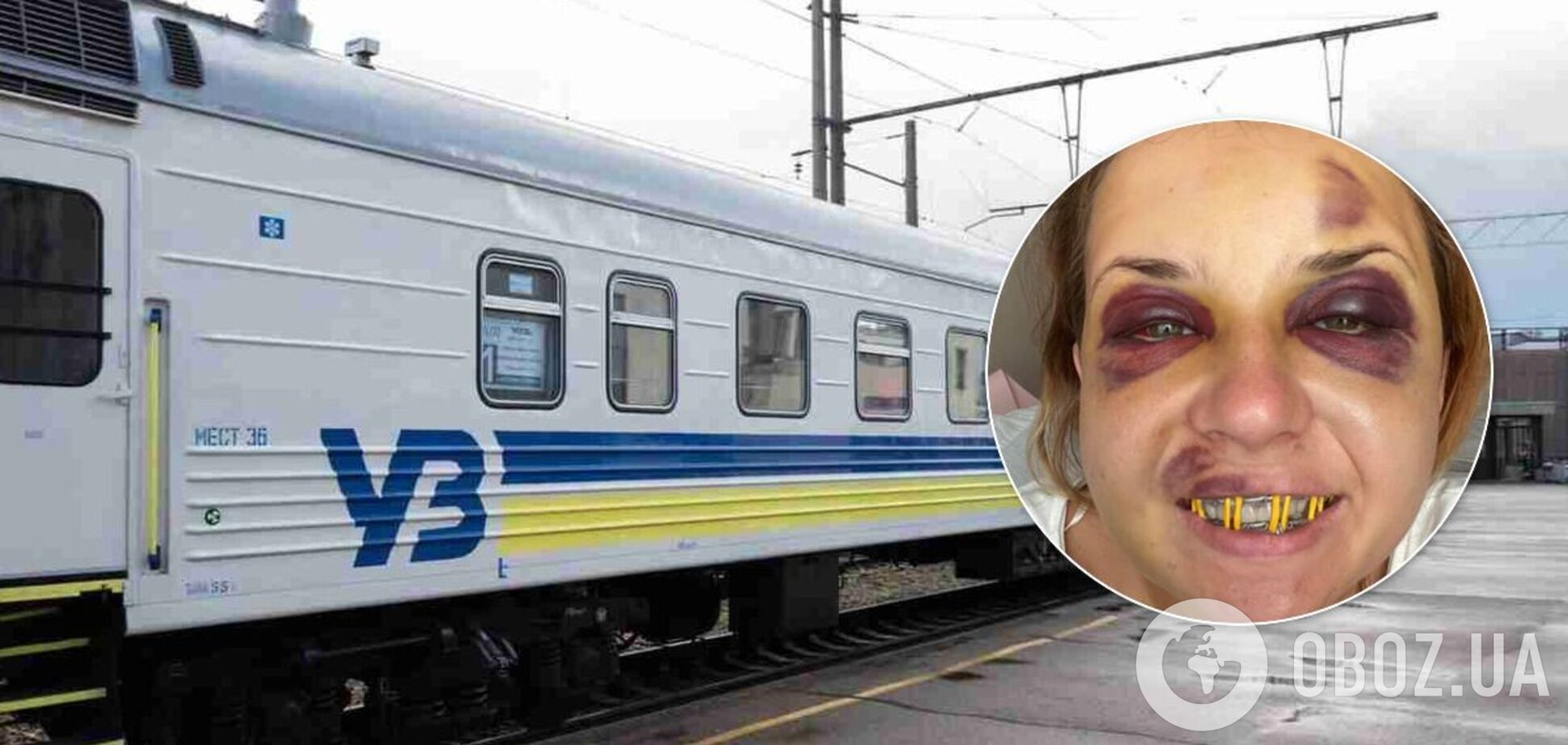 Жертва нападения в поезде УЗ рассказала о сложной операции: боль такая, словно зубы вырвали