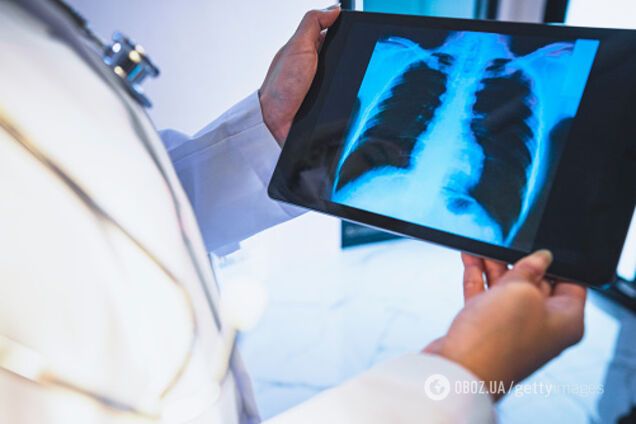 У тілі людини може ховатися коронавірус після одужання